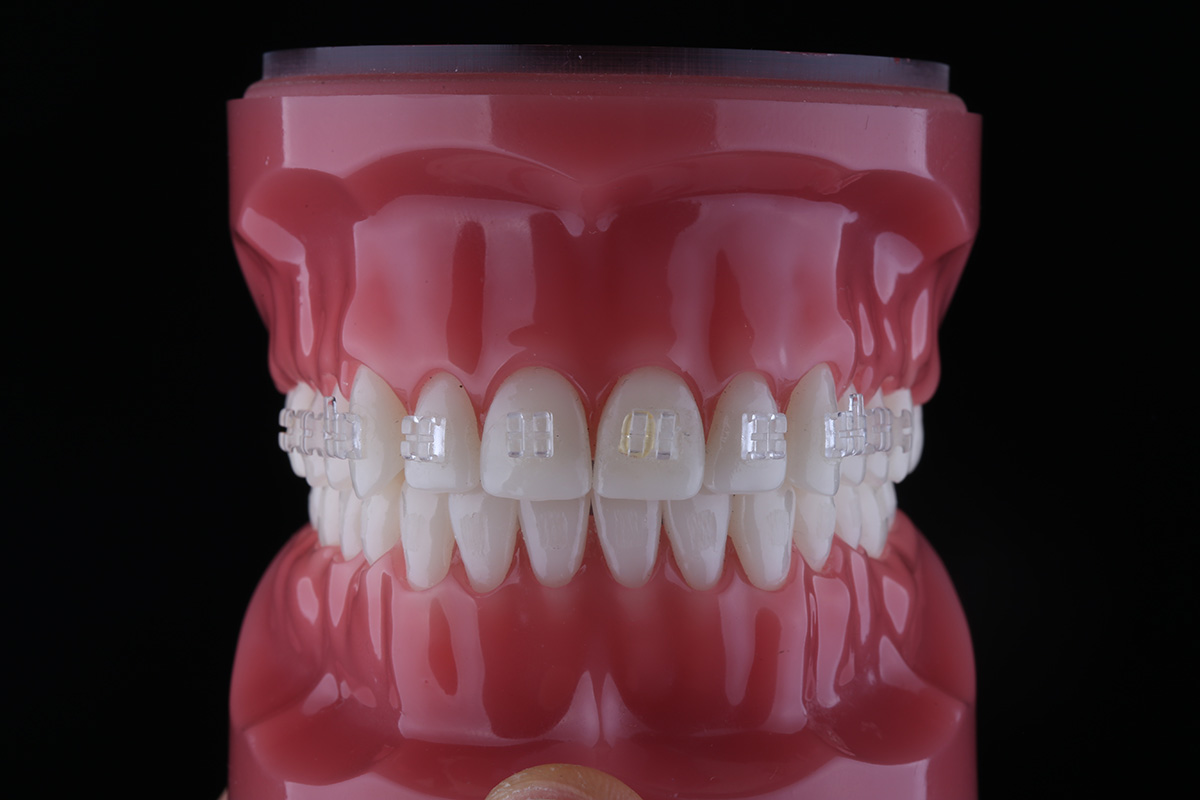 Dentalna fotografija