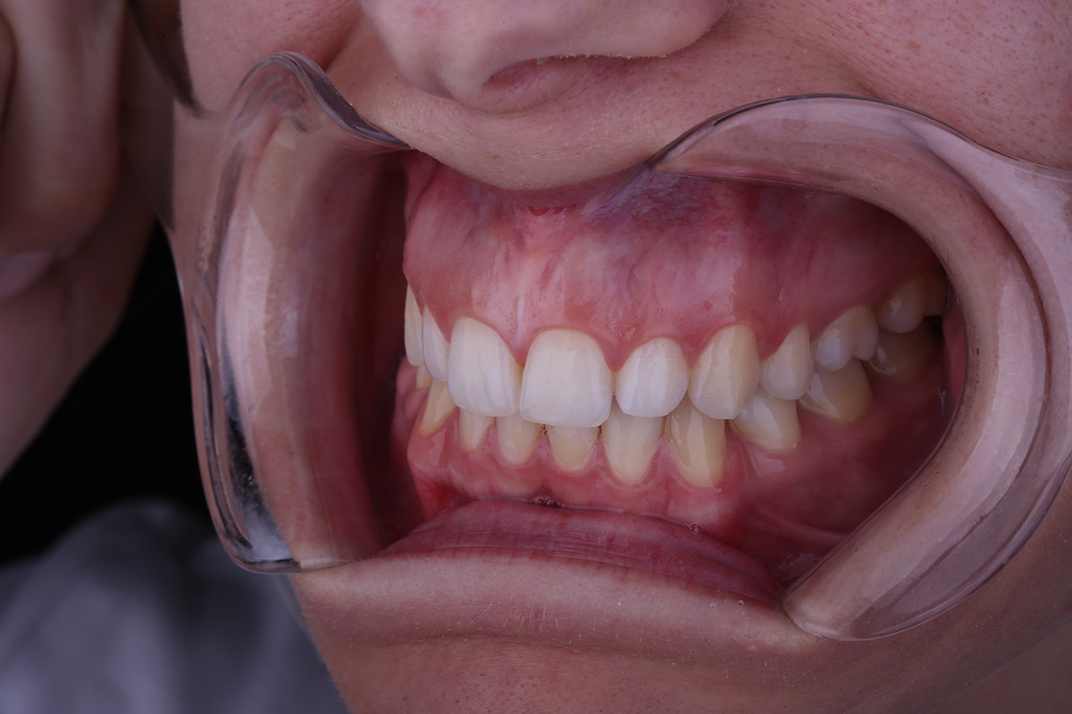 Dentalna fotografija