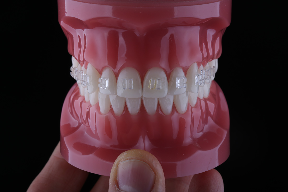 Dentalna fotografija