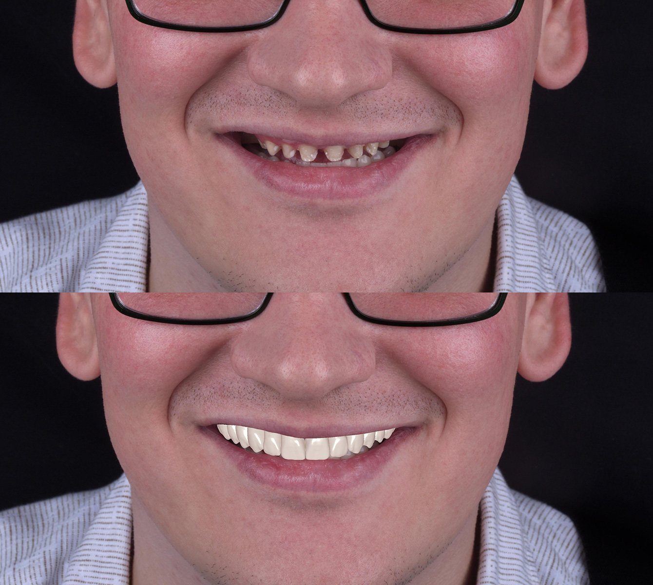 Usluga | Smile design